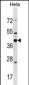 DND1 Antibody (Center)