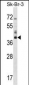 HSD17B1 Antibody (C-term)