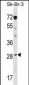 STAR Antibody (Center)