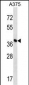 DPH1 Antibody (C-term)