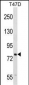 SEL1L Antibody (N-term)