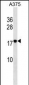 RHOF Antibody (C-term)