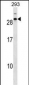 CDCA4 Antibody (C-term)