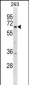 DYRK1B Antibody (Center)