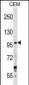 GREB1 Antibody (Center)