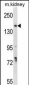 GREB1 Antibody (Center)