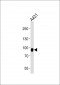 DSC3 Antibody (C-term)