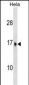 UBE2D3 Antibody (C-term)