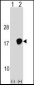 UBE2D3 Antibody (C-term)