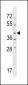 NPRL2 Antibody (C-term)