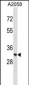 MGLL Antibody (N-term)