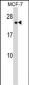 CHMP1A Antibody (N-term)