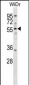 ASNS Antibody (N-term)