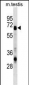 ASNS Antibody (N-term)