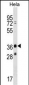 MAGEB16 Antibody (C-term)