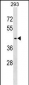 SERINC3 Antibody (C-term)