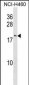 CCL27 Antibody (C-term)