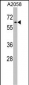 RIC8A Antibody (Center)