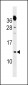 CKS1B Antibody (Center)