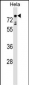 TBX2 Antibody (Center)