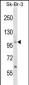 PPP1R13B Antibody (Center)