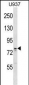 OS9 Antibody (C-term)