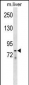 LOXL4 Antibody (C-term)