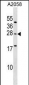 EPDR1 Antibody (Center)