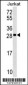 ANP32C Antibody (Center)