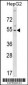 GLTSCR2 Antibody (C-term)