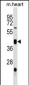 Mouse Uhmk1 Antibody (N-term)