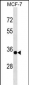 EPSTI1 Antibody (N-term)