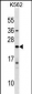 IFNA10 Antibody (C-term)