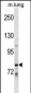 DACH1 Antibody (Center)