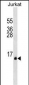 PATE1 Antibody (C-term)