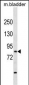 TBR1 Antibody (N-term)