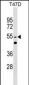 HNRPLL Antibody (N-term)