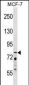 ZNF828 Antibody (Center)