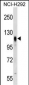 PROM2 Antibody (Center)