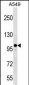 ZC3H7A Antibody (Center)