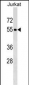 PNMA3 Antibody (C-term)