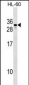 CGB1 Antibody (N-term)