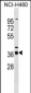 SERTAD2 Antibody (N-term)