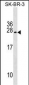 TUSC5 Antibody (Center)