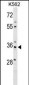 PDLIM4 Antibody (Center)