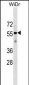 AGPAT9 Antibody (Center)