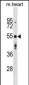 AGPAT9 Antibody (Center)