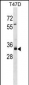 MYEOV Antibody (Center)