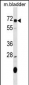 OSGIN1 Antibody (C-term)