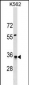 HMGCL Antibody (N-term)